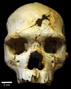 3 - Evidenze di violenza interpersonale sull’osso frontale del cranio neandertaliano ATA SH-17, dal sito spagnolo di Atapuerca-Sima de los Huesos, vecchio di 430,000 anni. Immagine dalla rivista PLOS One (maggio 2015).